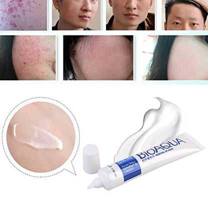 Crema Facial Antiacné